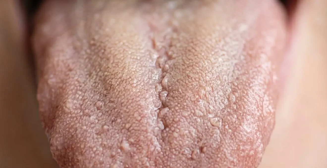 Close-up macro view of tongue surface showing texture and coating detail for TCM diagnosis